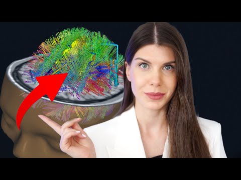 Mind Uploading is Closer Than You Think